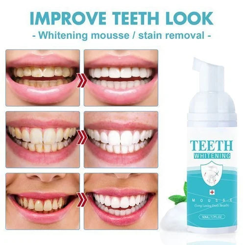 Teeth Whitening PAP +